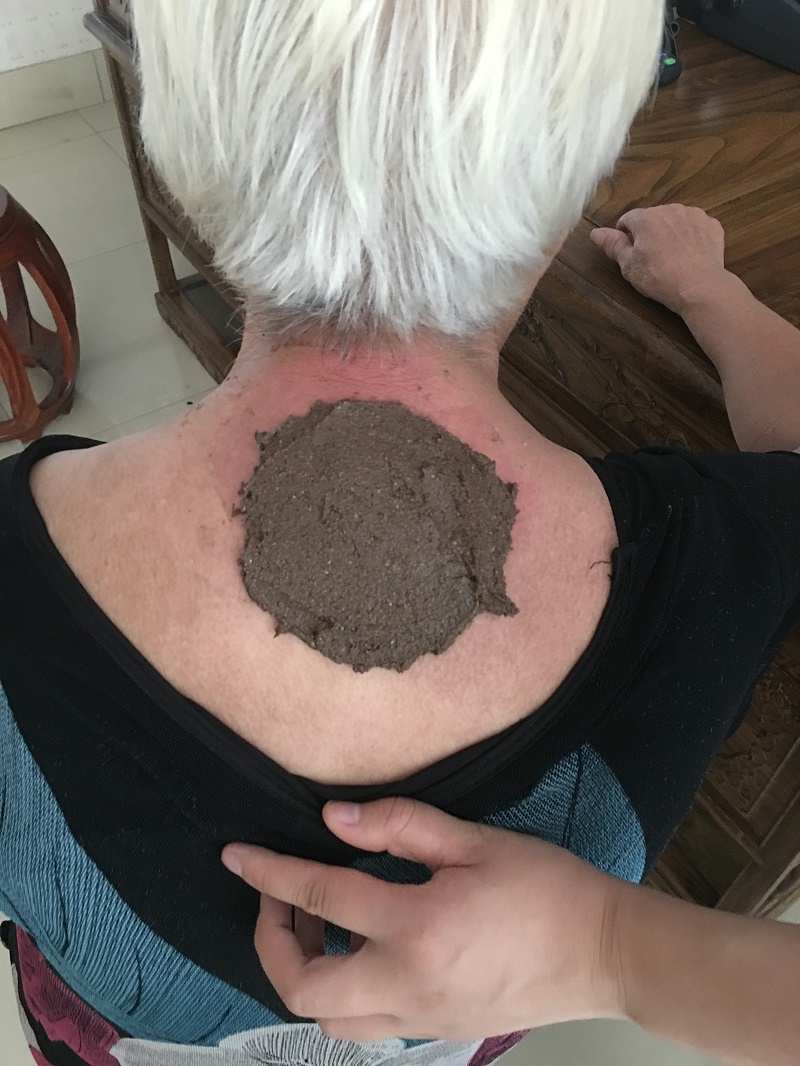 别让这个坏习惯毁掉你的颈椎！金铠甲膏药疗法：颈椎病再也不犯！