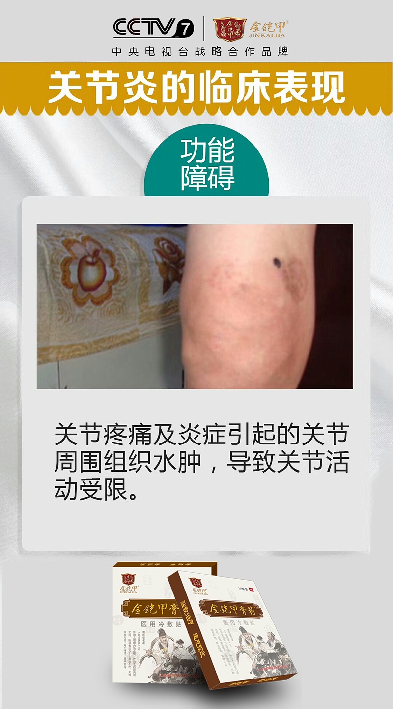 金铠甲膏药告诉您关节炎造成的功能障碍