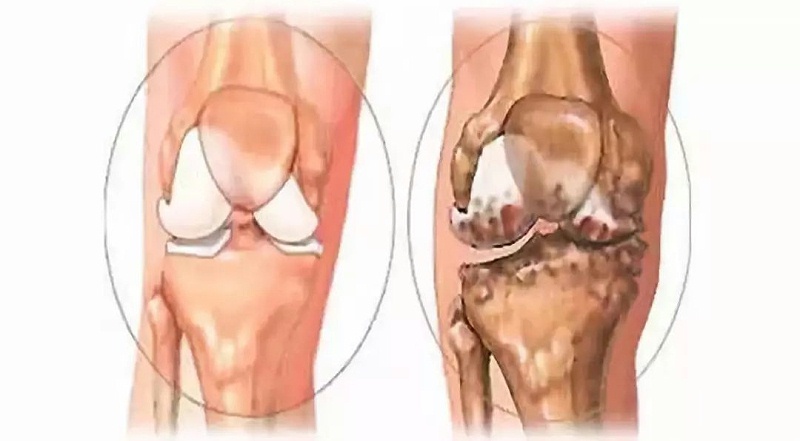 膝关节组织