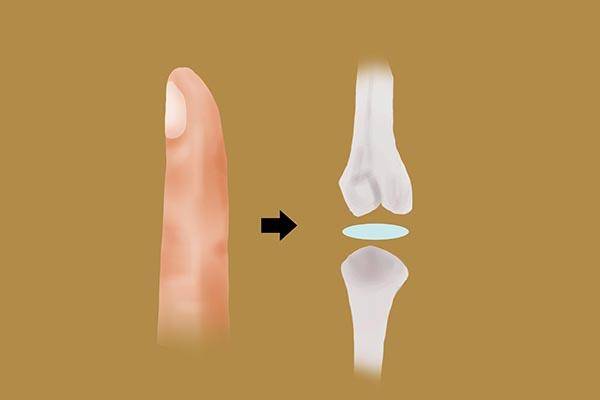 关节有响声是怎么回事